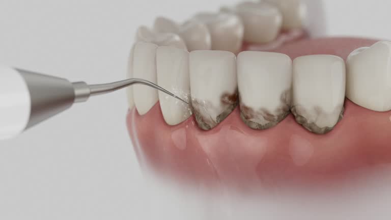 Trusted Teeth Whitening service in Owasso, OK - Dentist Open Now
